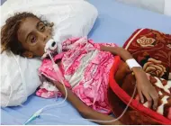 ?? (Abduljabba­r Zeyad/Reuters) ?? JAMILA ALI ABDU, seven, lies on a hospital bed in the Red Sea port city of Hodeidah, Yemen, on Tuesday. She died later in the day.