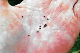  ?? Ruth Renner via New York Times ?? Long-horned ticks, known locally as cattle ticks, on a farm in New Zealand. These ticks are known to kill small animals.