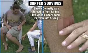  ?? ?? SURFER SURVIVES
Shawn Donnelly was forced to fight for his life when a shark sank its teeth into his leg