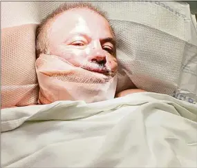  ?? Contribute­d photos ?? Above and right, Luke O’Brien, 60, of Milford, needed 300 stitches after he was slashed with a circular cutting tool by a catalytic converter thief outside his home this week.