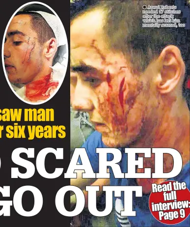  ??  ?? ● Arwel Roberts needed 17 stitches after the attack which has left him mentally scarred, too