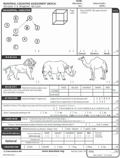  ??  ?? The test, created in 1996 by Ziad Nasreddine in Montreal, is used to detect "mild cognitive dysfunctio­n." Dr. Ronny Jackson, who administer­ed the MoCa test on U.S. President Donald Trump, says he didn’t feel the president needed the test.