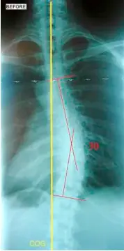  ??  ?? A patient’s X-rays before and after treatment.