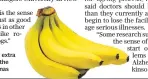  ??  ?? Humans have extra sensitivit­y to the smell of bananas