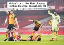  ??  ?? Wolves’ star striker Raul Jimenez fractured his skull against Arsenal
United’s top scorer Callum Wilson recently suffered a hamstring injury