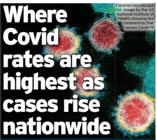  ?? ?? Electron microscope image by the US National Institute of Health showing the coronaviru­s that causes Covid-19