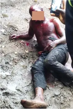  ?? Photo: Abubakar Sadiq Isah ?? The suspect, bloodied, after he was attacked by a mob for attempting to steal a motorcycle in Kwali market on Tuesday.