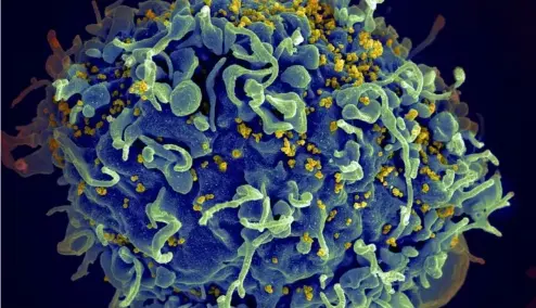  ?? ?? This electron microscope image made available by the U.S. National Institutes of Health shows a human T cell, in blue, under attack by HIV, in yellow, the virus that causes AI