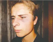  ??  ?? What happened to Jeremia Leussink, 18, on July 31 on a rural roadside near Olds comes on the heels of a summer of discontent, if not outright rage, following the videotaped choking death by police of George Floyd in Minneapoli­s, Minn., on May 25, writes Licia Corbella.