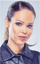  ??  ?? Acid ordeal... Katie Piper, 35