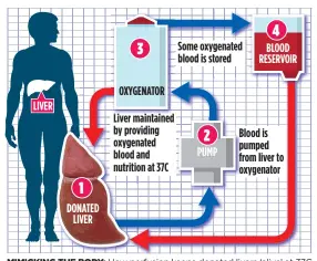  ??  ?? MIMICKING THE BODY: How perfusion keeps donated livers ‘alive’ at 37C