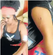  ?? Picture: FACEBOOK ?? MAJOR BLOW: East London-born Afro pop singer Zahara was allegedly stabbed.