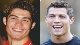  ??  ?? O jogador Cristiano Ronaldo aderiu às facetas para mudar o sorriso