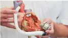  ??  ?? Researcher­s are still working on an artificial heart that can fully replace a natural heart