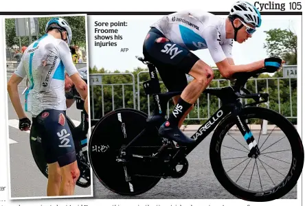  ?? AFP ?? Sore point: Froome shows his injuries