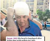  ??  ?? Egypt, 2013 His head is bandaged after being shot with pellets in Cairo