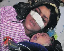  ?? Hasan Sirdash / AFP ?? Afghan Reza Gul, 20, whose nose was sliced off by her husband in an attack that prompted widespread revulsion.