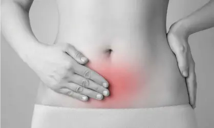  ??  ?? A study of 500 women found that obese women were twice as likely to have severe pain from endometrio­sis. Photograph: Alamy