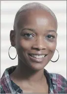 ?? — POSTMEDIA NEWS ?? Zielke, who has had alopecia areata since 2006, before treatment.