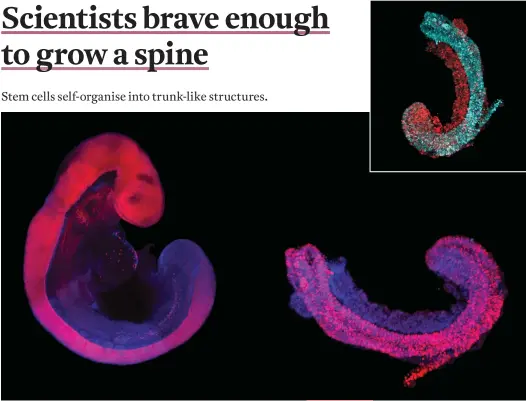  ??  ?? Comparison of nine-day-old mouse embryo grown in the womb (left) and the trunklike-structure (right) grown in situ. The neural tube, which eventually makes the spinal cord, is in pink; all other tissues are blue. Top:
Fluorescen­t microscopi­c image of a trunk-likestruct­ure.