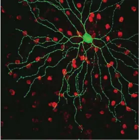  ??  ?? A photosensi­tive nerve cell in the retina of a mouse. The green color shows the location of the photosensi­tive pigment melanopsin, which is responsibl­e for most nonvisual photorecep­tion in mammals.