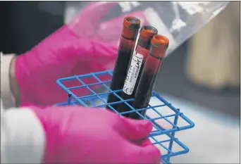  ??  ?? A patients blood samples are seen during a COVID-19 vaccinatio­n study at Research Centers of America in Hollywood, Fla.