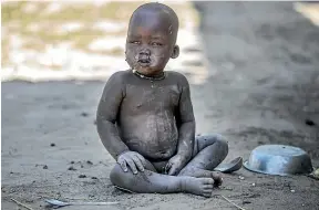  ??  ?? Sixty per cent of South Sudan’s people are facing severe hunger.