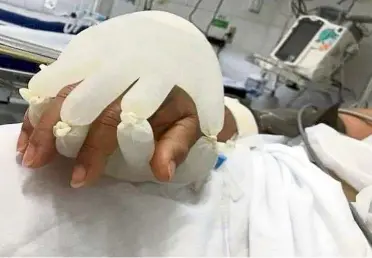  ?? (Photo courtesy of Public Health Malaysia on Facebook.) ?? Touch of comfort: The hand of an unconsciou­s hospital patient being ‘clasped’ by two surgical gloves filled with warm water.