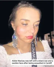  ??  ?? Abbie Mackay was left with a black eye and a swollen face after being assaulted in Cardiff