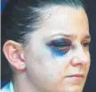  ?? Picture: JUSTIN BRIERTY ?? BLACK AND BLUE: Senior Constable Tenelle Luscombe after the attack in 2007 and ( below) in Cairns on Saturday.