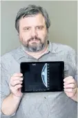  ?? RICHARD VOGEL/AP PHOTO ?? Associated Press reporter Andrew Dalton holds an iPad displaying an image of his mammogram in downtown Los Angeles. Dalton described his experience as the rare man who underwent a mammogram in a story for the AP.