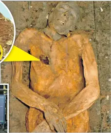  ?? ?? Múmia
A nápolyi apátság sírkamrájá­ban megtalált test elképesztő­en jó állapotban maradt négyszáz éven át