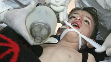  ??  ?? Suffering: A child is treated after a chemical attack in Khan Sheikhoun, Syria, last April