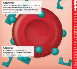  ??  ?? Antistoffe­rHvis antigenene er altfor forskjelli­ge, vil mottakeren­s immunforsv­ar tolke den nye nyren som et fremmedele­ment, og angripe med antistoffe­r som kan føre til avvisning.AntigenerA­ntigener fra mottakeren­s ABOblodgru­ppe og HLA- system bør være så like hverandre som mulig.