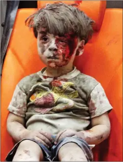  ??  ?? HEARTBREAK­ING: The photo of five-year-old Omran Daqneesh