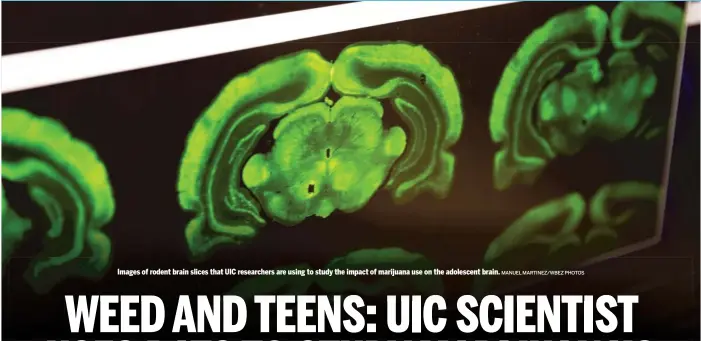  ?? MANUEL MARTINEZ/WBEZ PHOTOS ?? Images of rodent brain slices that UIC researcher­s are using to study the impact of marijuana use on the adolescent brain.