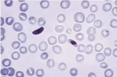  ?? EUROPA PRESS ?? Plasmodium falciparum, un parásito que causa la malaria cerebral.