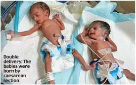  ??  ?? Double delivery: The babies were born by caesarean section