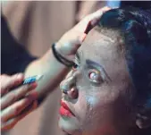  ?? STR, AFP/GETTY IMAGES ?? Victims of acid attacks say they must deal with lifelong repercussi­ons. British law does not specifical­ly ban acid as a weapon.