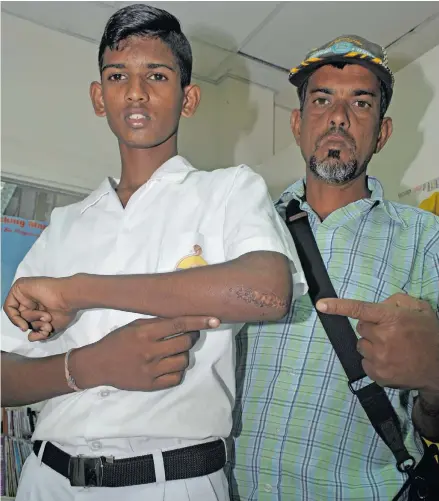  ?? Waisea Nasokia ?? Swami Vivekanand­a College student Alokh Jiwan Vikash with his father Jagjiwan Vikash show the injuries sustained in the fall.