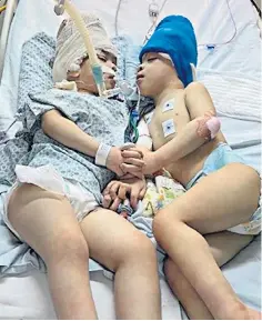  ?? ?? Brazilian twins Bernardo and Arthur Lima, aged three, after their 27 hours in surgery