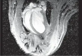  ?? Stanford University ?? A CARDIAC MRI of a lab animal that underwent photosynth­etic therapy with cyanobacte­ria — one of the oldest, most important groups of bacteria on Earth.