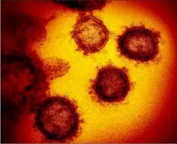  ?? Zuma Press/TNS ?? An image from an electron microscope shows SARS-CoV-2, the virus that causes COVID-19.