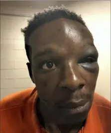  ?? The Cochran Firm via AP ?? This Saturday photo provided by The Cochran Firm shows Roderick Walker at the Clayton County Jail in Jonesboro, Ga. The county sheriff's office said Sunday that it fired a deputy seen on video repeatedly punching Walker during a traffic stop.
