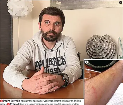  ??  ?? 1Pedro Estrella apresentou queixa por violência doméstica há cerca de dois meses 2Vítima fotografou as agressões que terão sido feitas pela ex-mulher