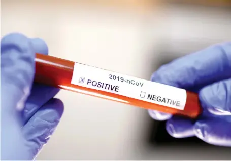  ?? (Dado Ruvic/File Photo/Reuters) ?? TEST TUBE with coronaviru­s label is seen at the end of January.