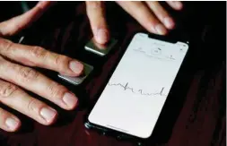  ?? HANNAH YOON/THE NEW YORK TIMES ?? The KardiaMobi­le app records a medical-grade EKG in 30 seconds after a person places their fingers on the sensors.