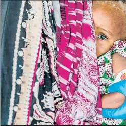  ?? WFP ?? Un nadó d’onze mesos, de Nigèria, que pateix malnutrici­ó aguda
