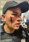  ?? SUBMITTED PHOTO ?? A Trenton officer was struck in the face with a bottle recently.