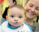  ??  ?? BEAUTIFUL BOY: Jacky Engela's son, Winston, was born with a cleft lip and cleft palate